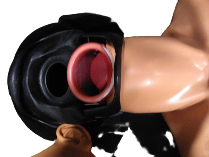 ALS-Ambuman-defekt-2